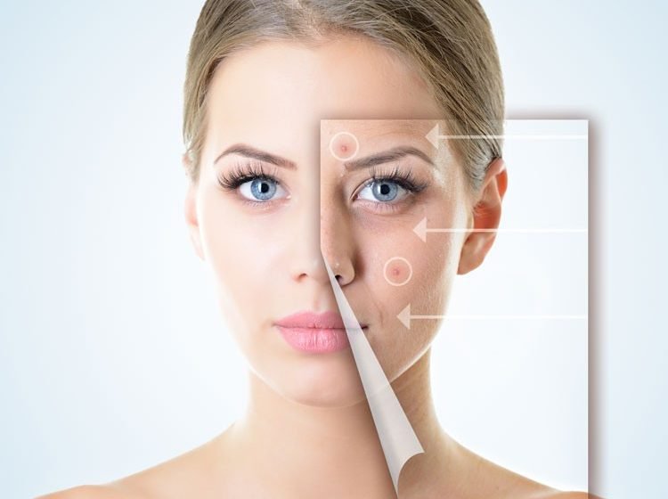 Acne Scar Treatment in Pimpri Chinchwad Pune