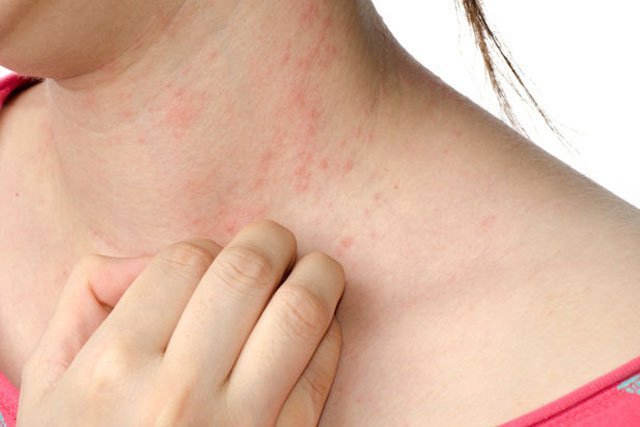 Skin Allergy Treatment in Pune