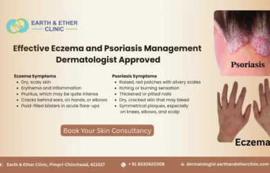 Effective Eczema and Psoriasis Management in Nigadi – Dermatologist Approved