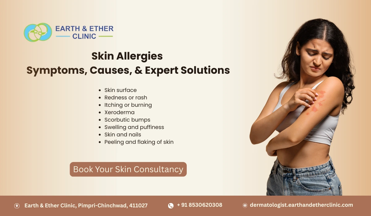 Skin Allergies: Symptoms, Causes, and Expert Solutions