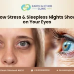 The Link Between Stress, Poor Sleep, and Early Signs of Aging Around the Eyes