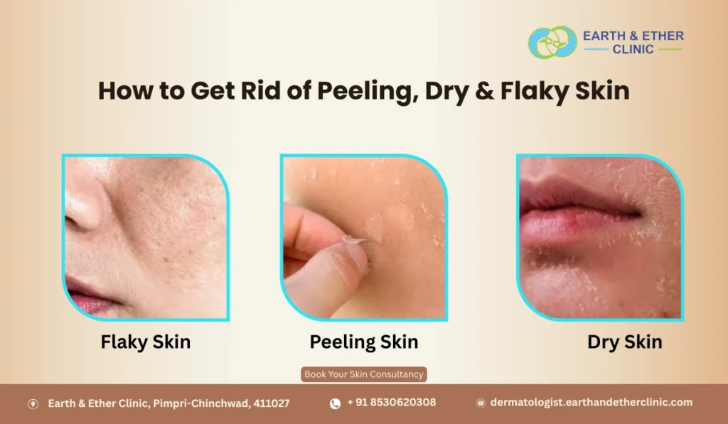 How to Get Rid of Peeling, Dry & Flaky Skin