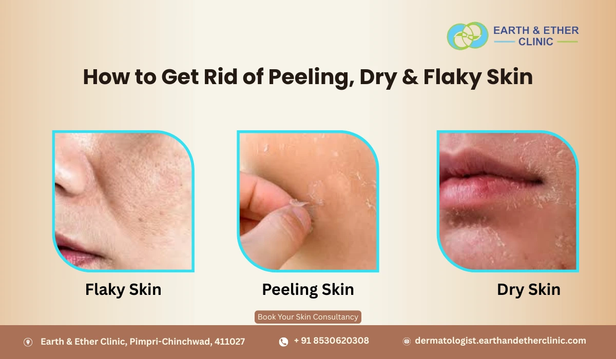 How to Get Rid of Peeling, Dry & Flaky Skin