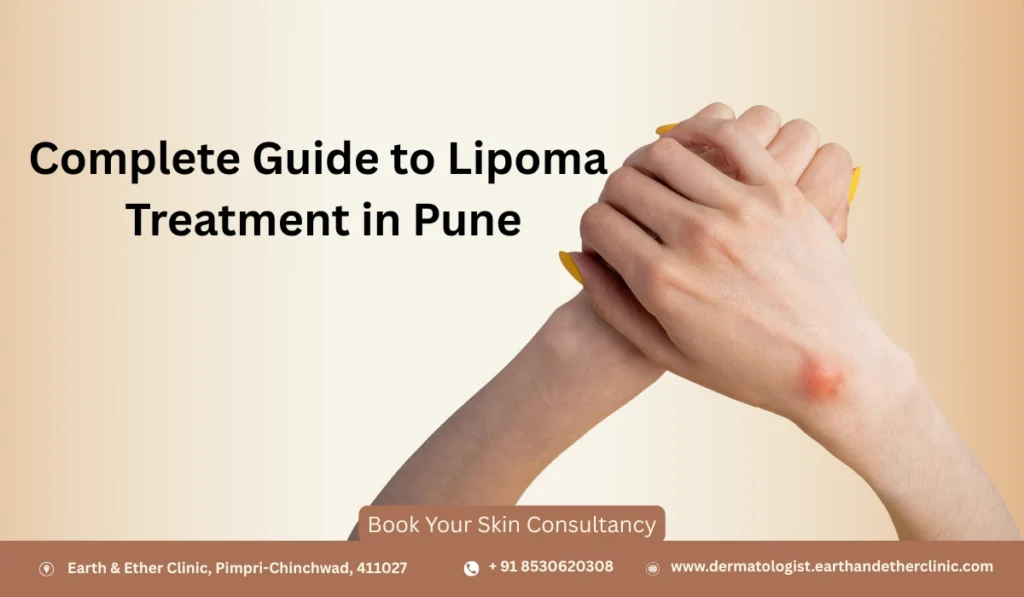 Complete Guide to Lipoma Treatment in Pune