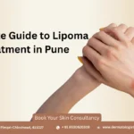 Complete Guide to Lipoma Treatment in Pune