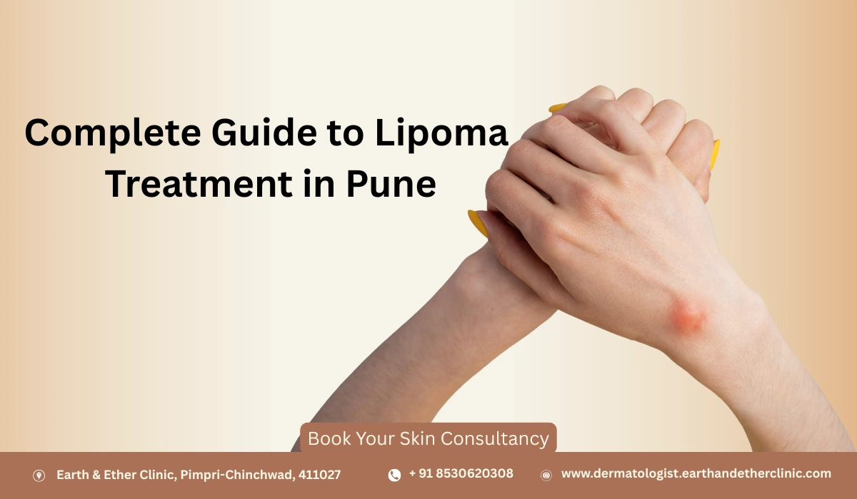 Complete Guide to Lipoma Treatment in Pune